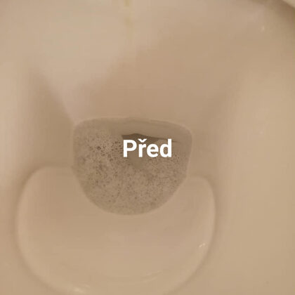 Moje foto Před a Po